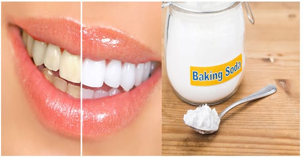 How to Make Your Teeth Whiter Naturally